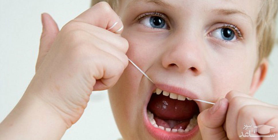نخ دندان کشیدن برای کودکان و سوالات متداول در این مورد