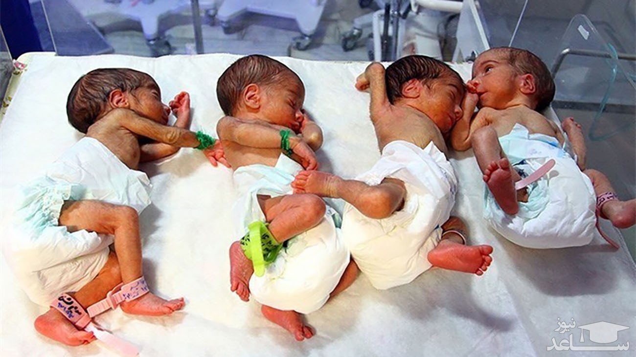 (فیلم) تولد چهارقلو‌ها در گرگان