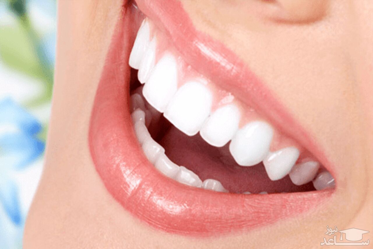 مکمل های طبیعی برای سلامت دندان و دهان