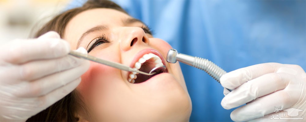 نکاتی برای کاهش خونریزی لثه بعد از کشیدن دندان