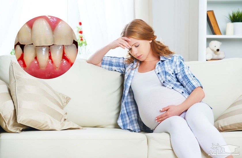 پیشگیری از پوسیدگی دندان ها و مشکلات لثه  در دوران بارداری