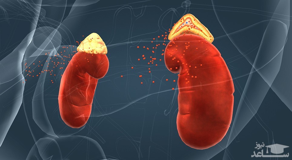 متخصص کلیه و مجاری ادراری می تواند چه بیماری هایی را درمان کند؟