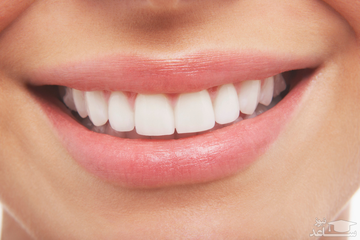 تفاوت بلیچینگ و جرمگیری دندان چیست؟