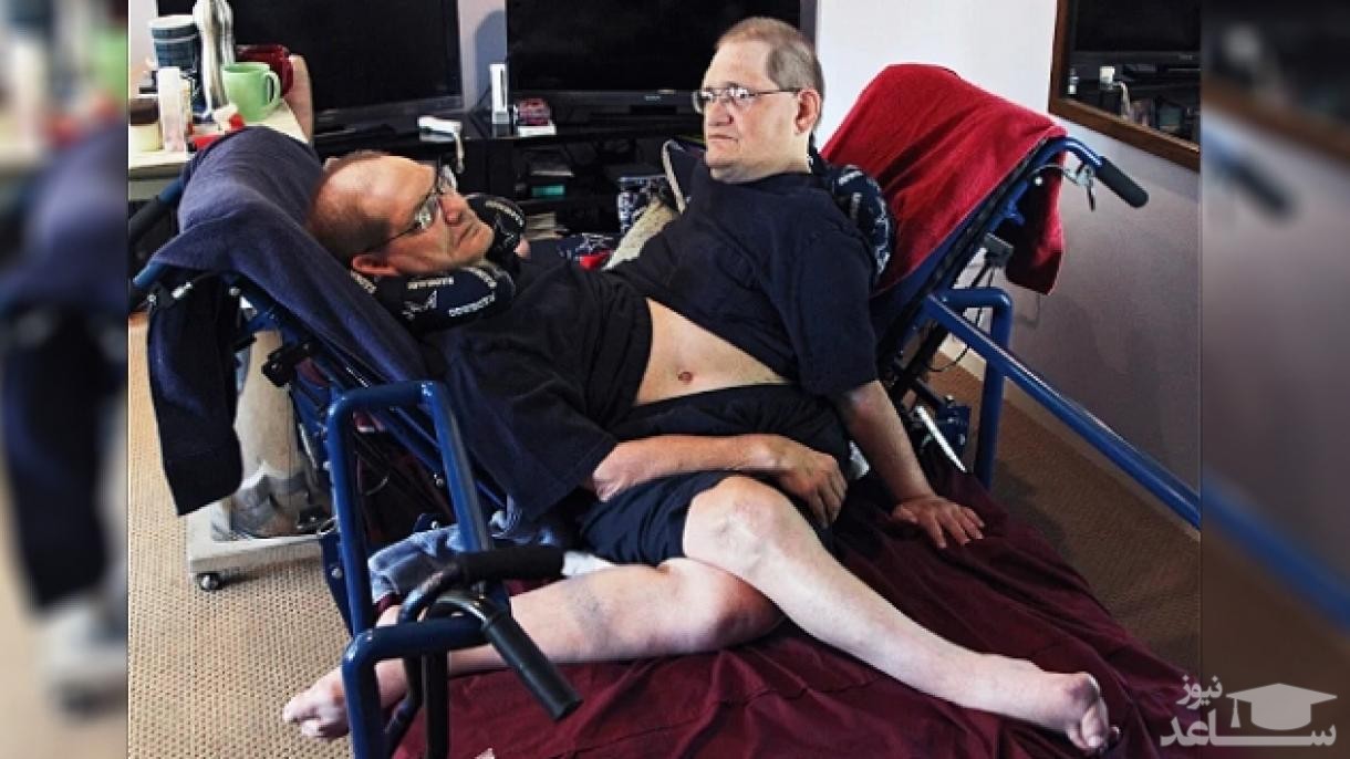 مرگ پیرترین دوقلو‌های به هم‌چسبیده جهان