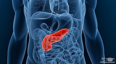 علل سرطان لوزالمعده و راههای درمان آن