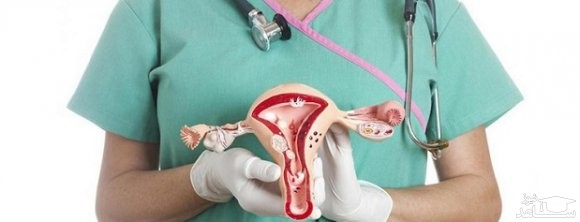 علل پولیپ دهانه رحم و راههای درمان آن