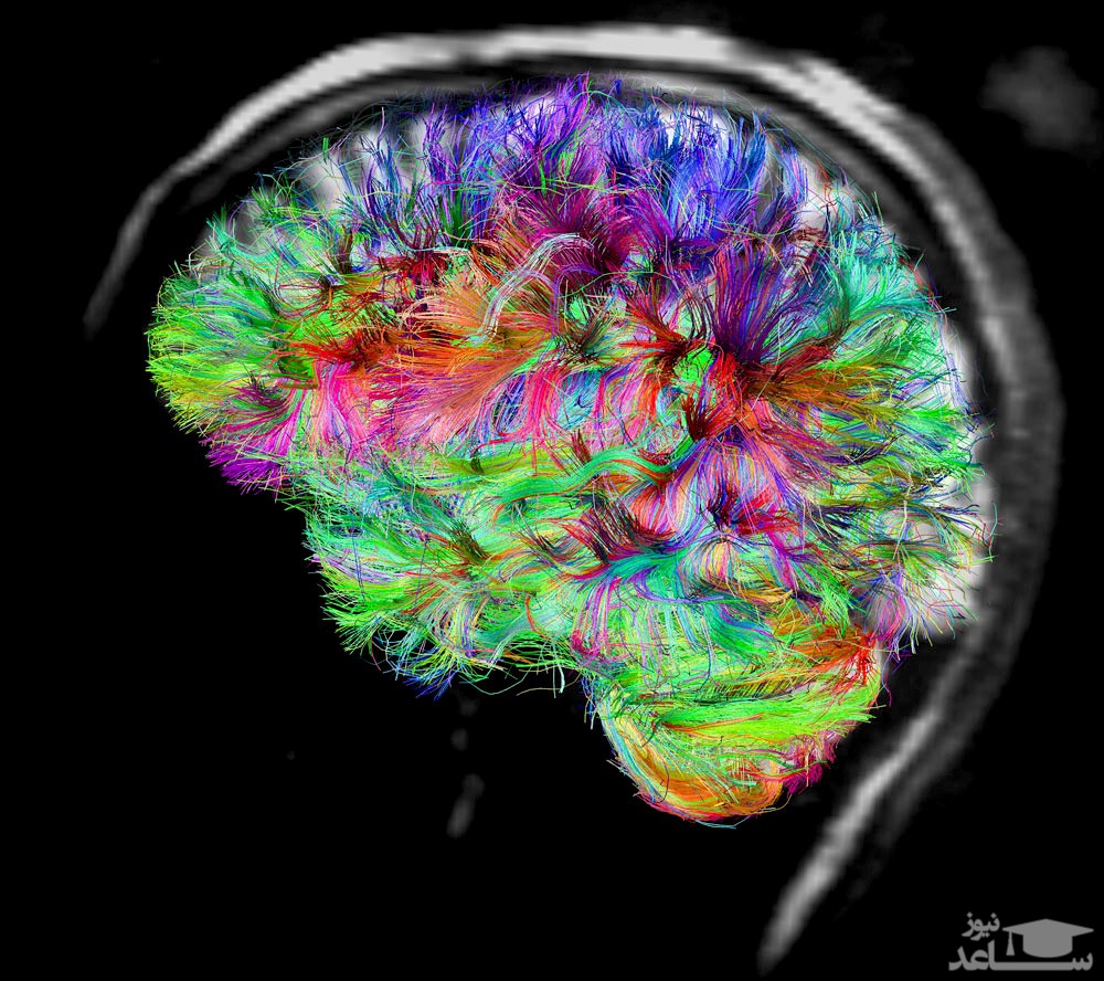 معماهای المپیادی و سخت برای تقویت فعالیت مغز