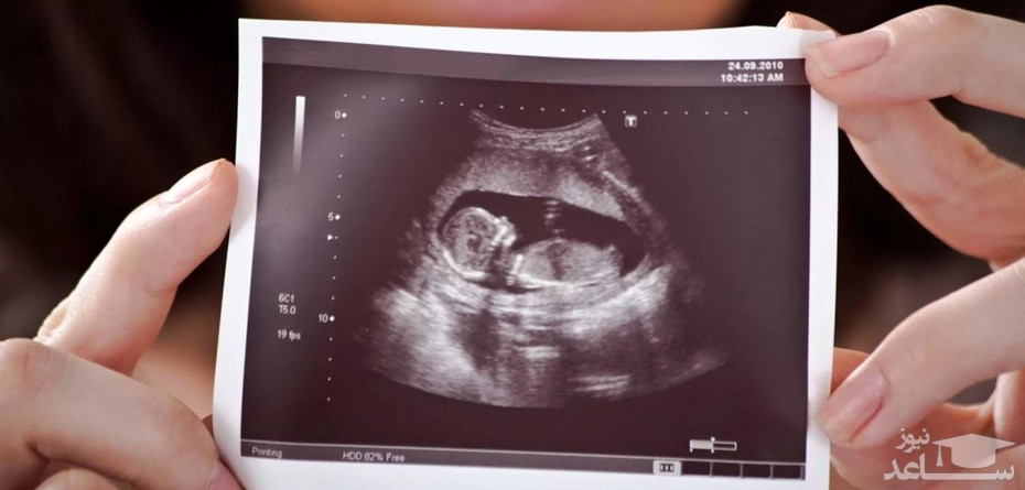نحوه انجام سونوگرافی واژینال در دوران بارداری