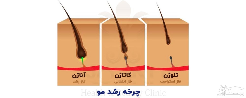 فازهای مختلف رشد مو