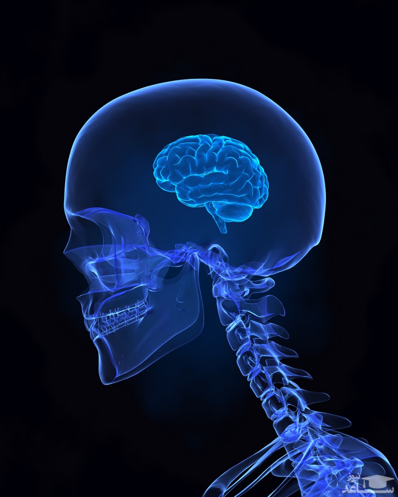 آتروفی مغزی چیست؟