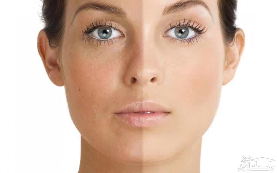 میزان، تاثیرات و مکانیزم اثر کرم تازاروتن