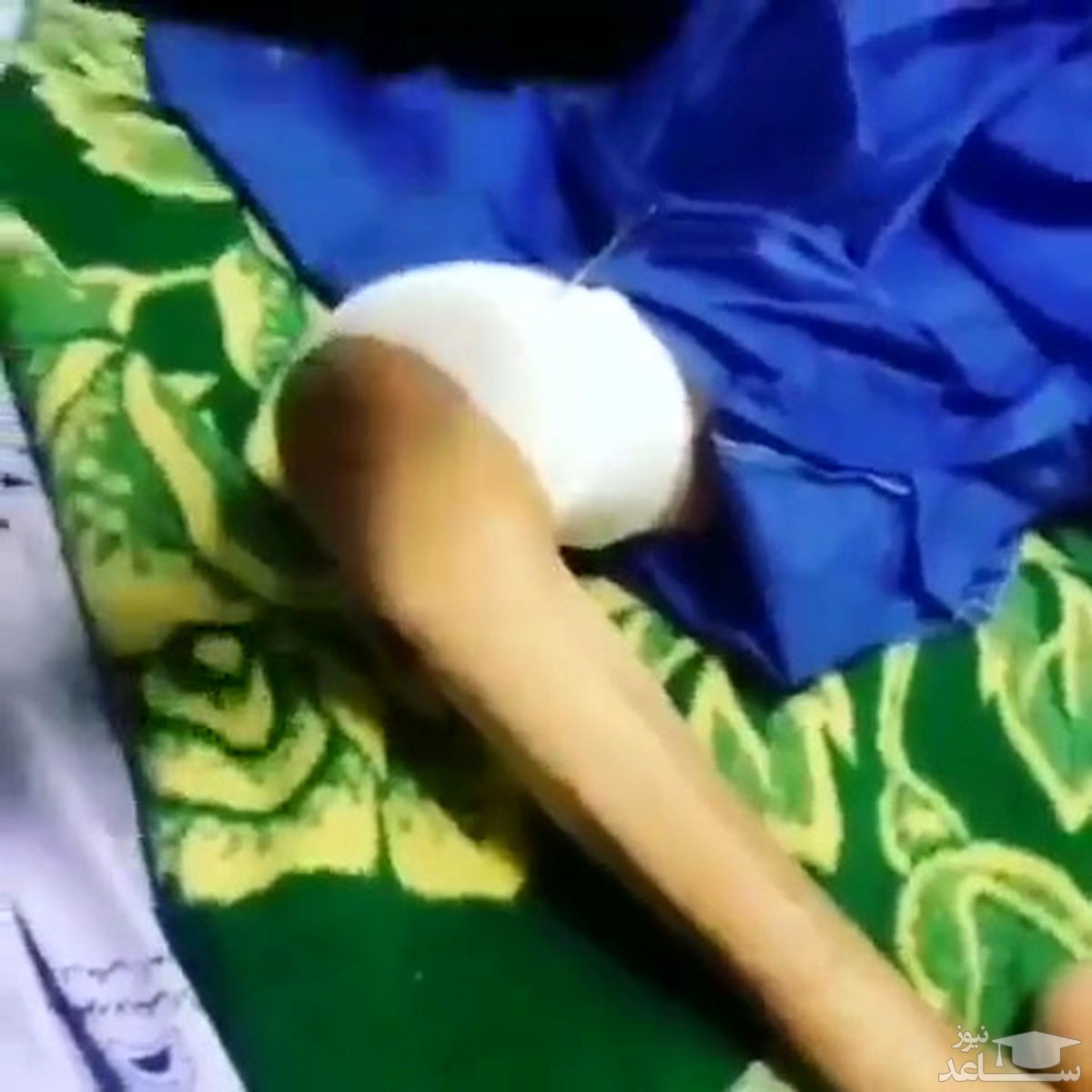 (فیلم) عمل جراحی اشتباهی در بیمارستان اراک سوژه شد