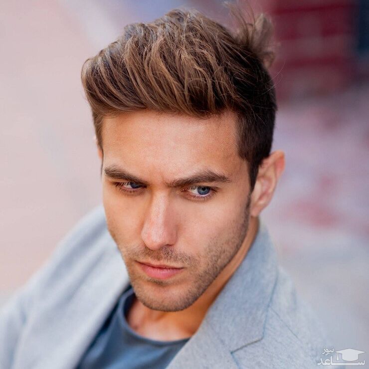 درمان شوره سر بعد از کاشت مو