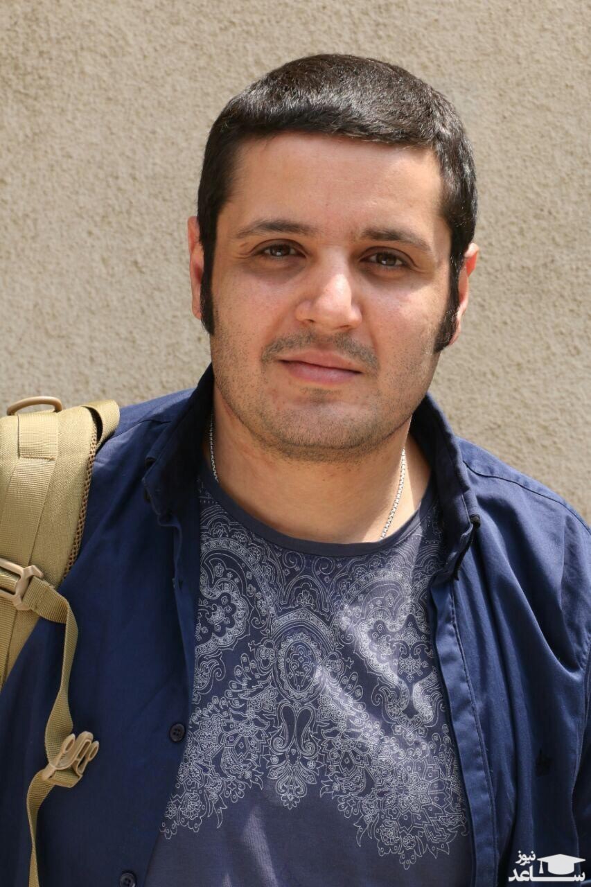 مهران رنجبر، بازیگری که چشم مصنوعی ساخت