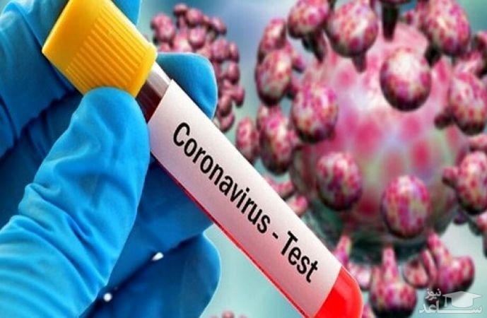 بازداشت مدیری که کرونا را جدی نگرفت