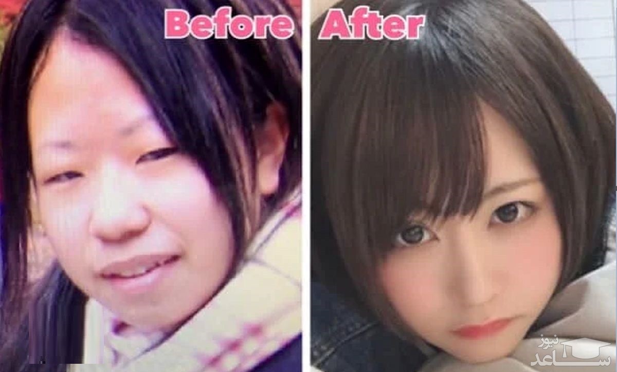 تغییر چهره باور نکردنی دختر ژاپنی پس از جراحی پلاستیک!