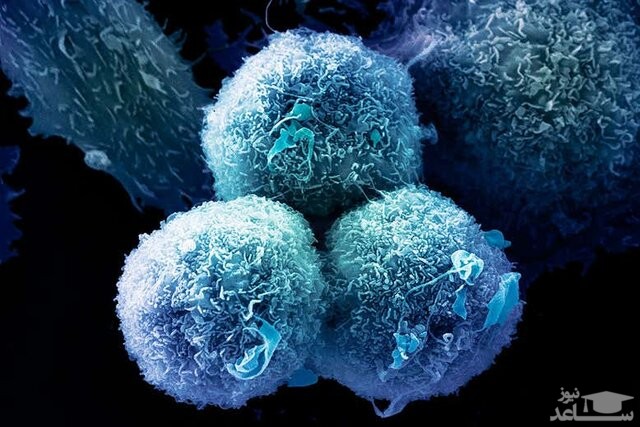 کشف داروی جدیدی که تومورهای سرطانی را از بین می‌برد