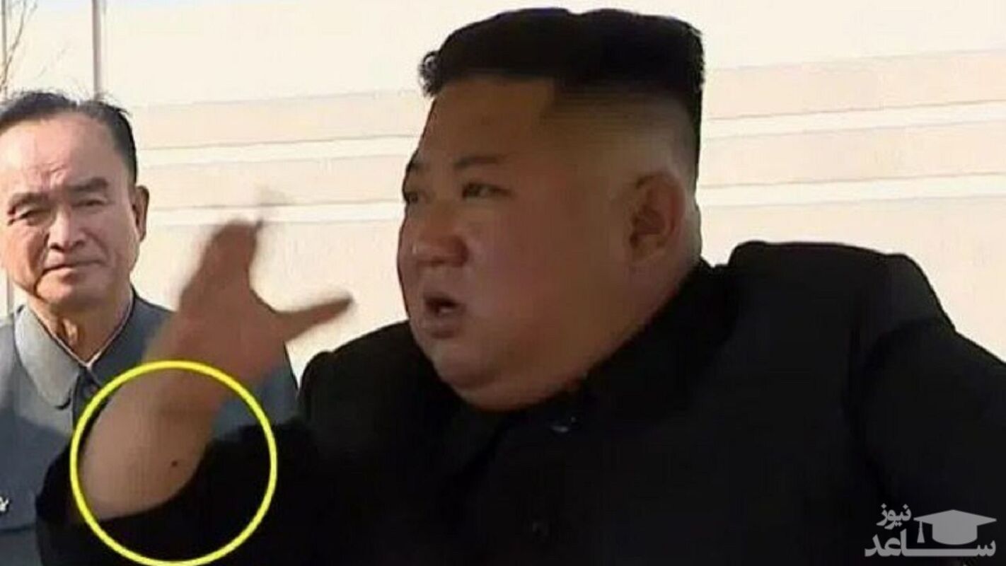 عمل قلب رهبر کره شمالی شایعه بود