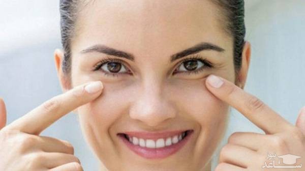 خانمی با چشم های پف دار