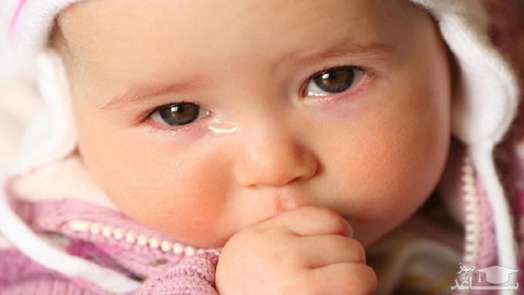 دلایل ریزش اشک چشم در کودکان و روش های درمان