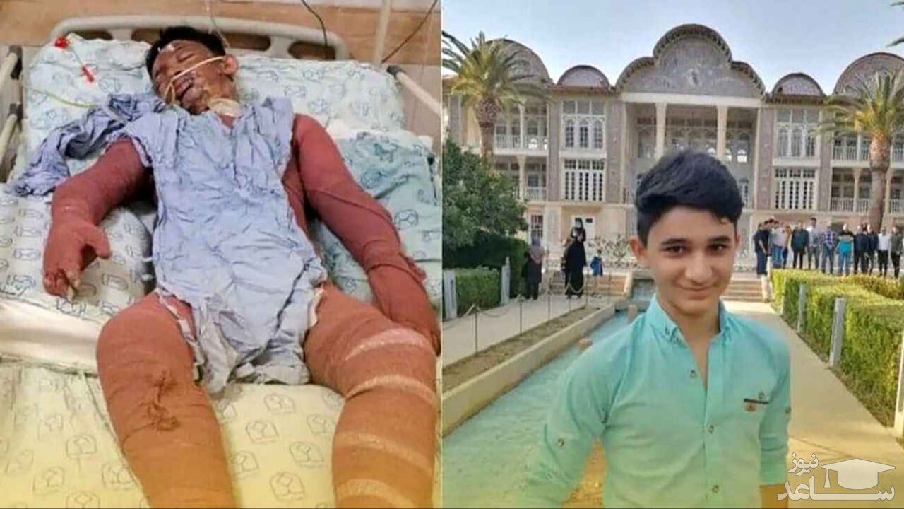 دستور فوری وزیر کشور برای پیگیری درمان نوجوان فداکار ایذه‌ای