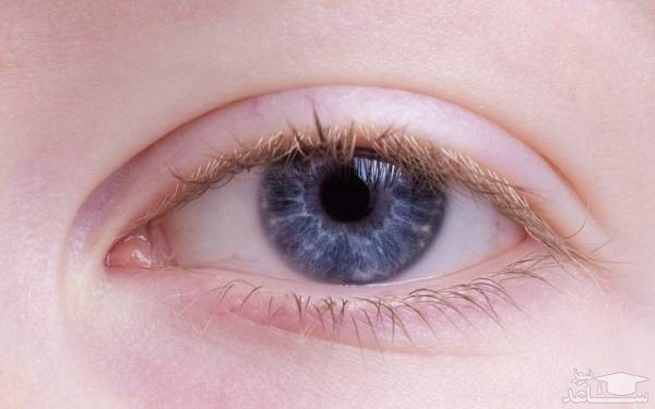 اگر دچار ریزش مژه هستید، بخوانید!