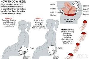 ورزش کگل برای تنگ کردن واژن