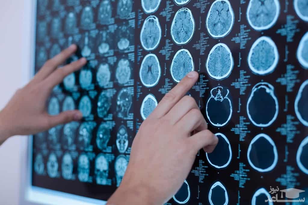 موارد منع مصرف و تداخل دارویی ریواستیگمین