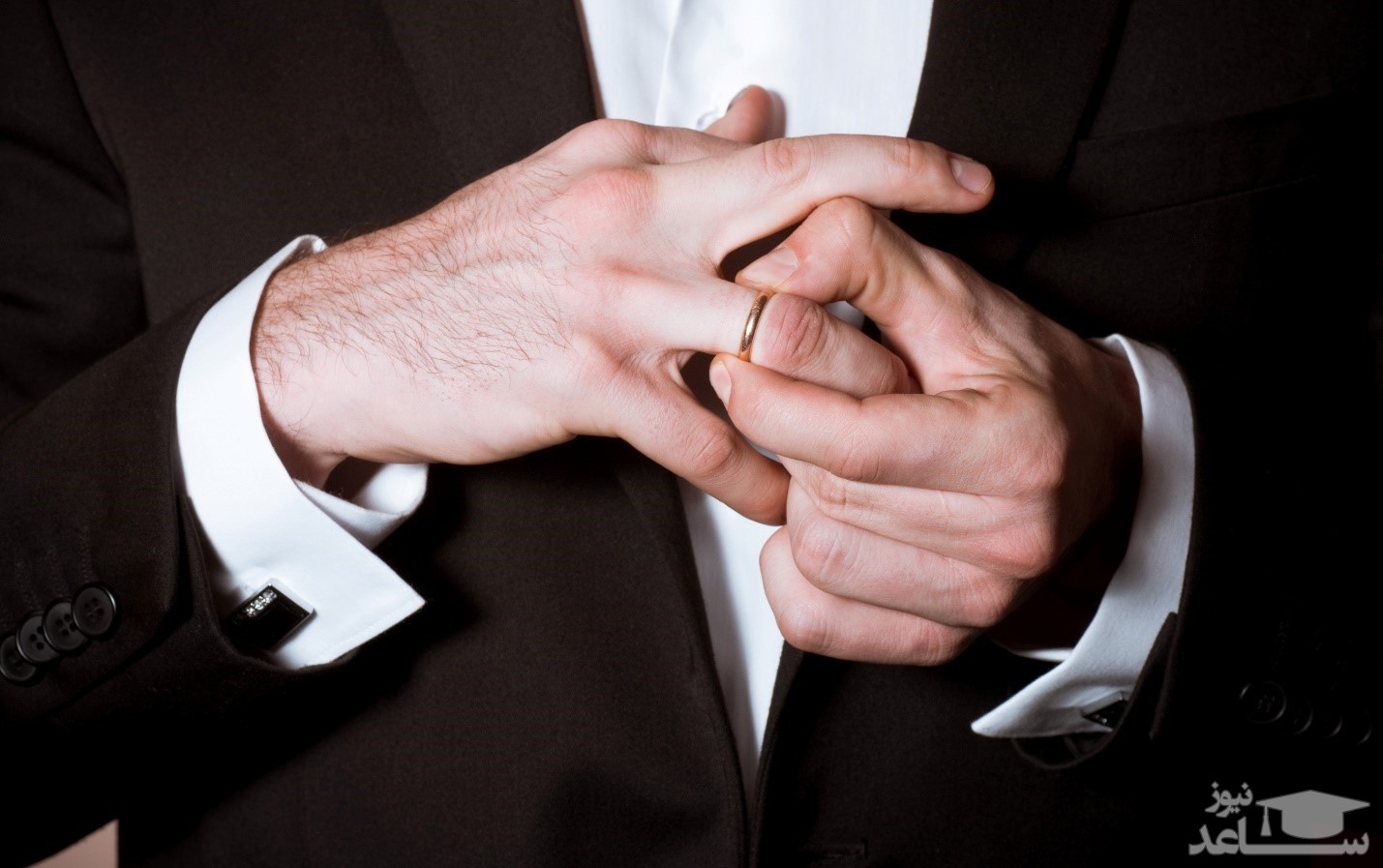 علت حساسیت پوست به طلا و جواهر