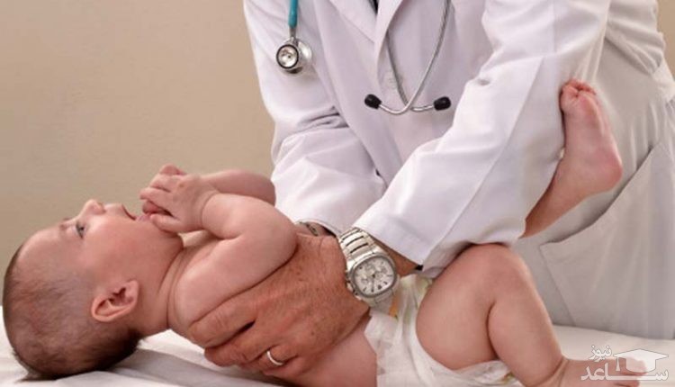 مشکلات بیضه در کودکان