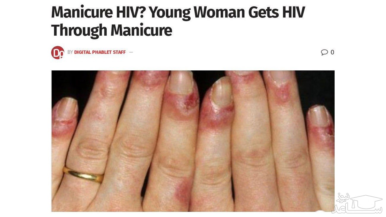 بلای شوم بر سر یک زن در آرایشگاه زنانه / زن جوان ایدز گرفت