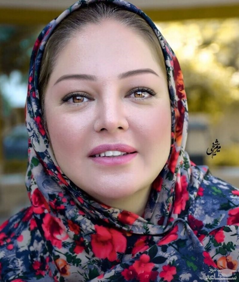 چهره تغییر کرده رزیتا غفاری