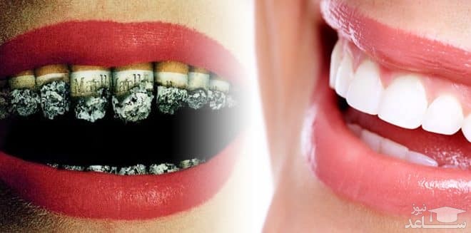 تاثیر سیگار بر سلامتی دهان و دندان