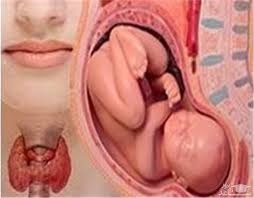 تاثیر پرکاری و کم کاری تیروئید زنان باردار بر رشد مغزی جنین