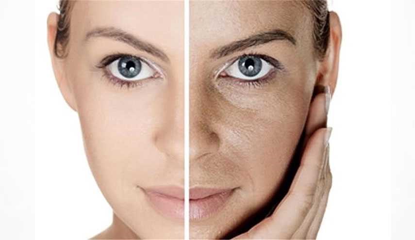 نشانه های کمبود ویتامین ها و مواد غذایی در چهره شما