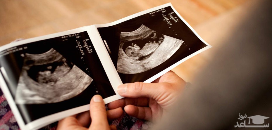 تاثیر کرونا بر بارداری و سلامت جنین