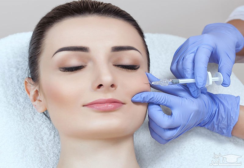 برجسته کردن گونه بدون عمل جراحی