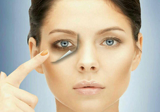 علت گودی زیر چشم و درمان آن