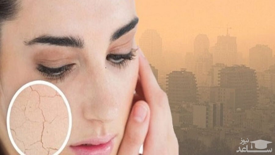 آلودگی هوا چه تاثیری روی سلامت پوست ما دارد؟