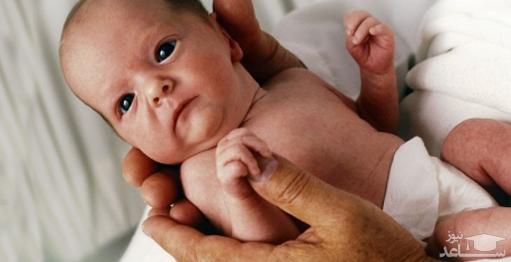 عارضه آمبولی لخته خون در زایمان های سزارین