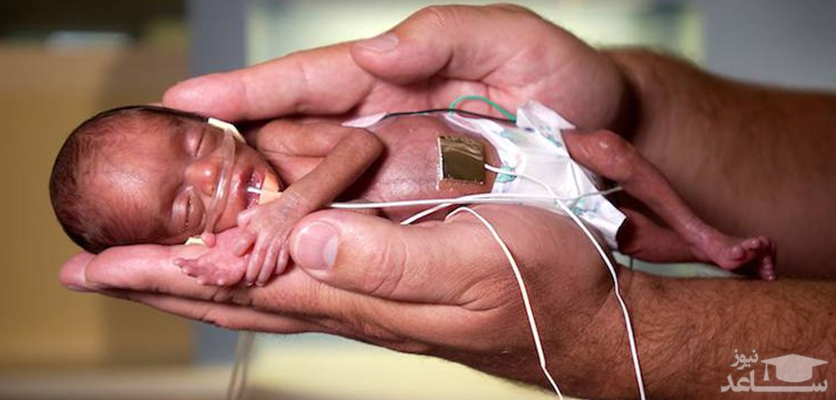 تاثیر تغییرات آب و هوایی در زایمان زودرس زنان