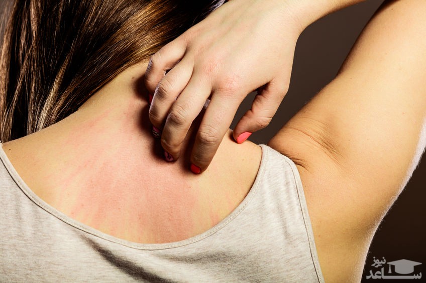 خانمی در حال خاراندن پشتش