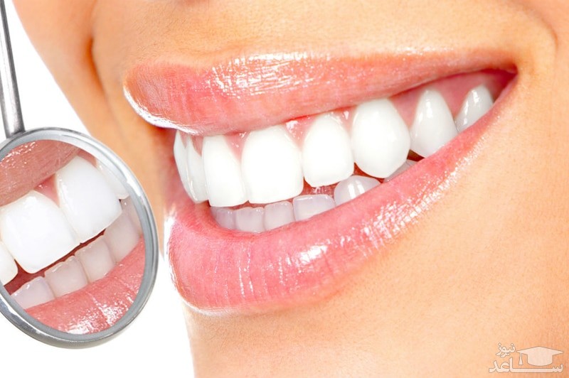 استفاده از جوش شیرین برای سفید کردن دندان ها