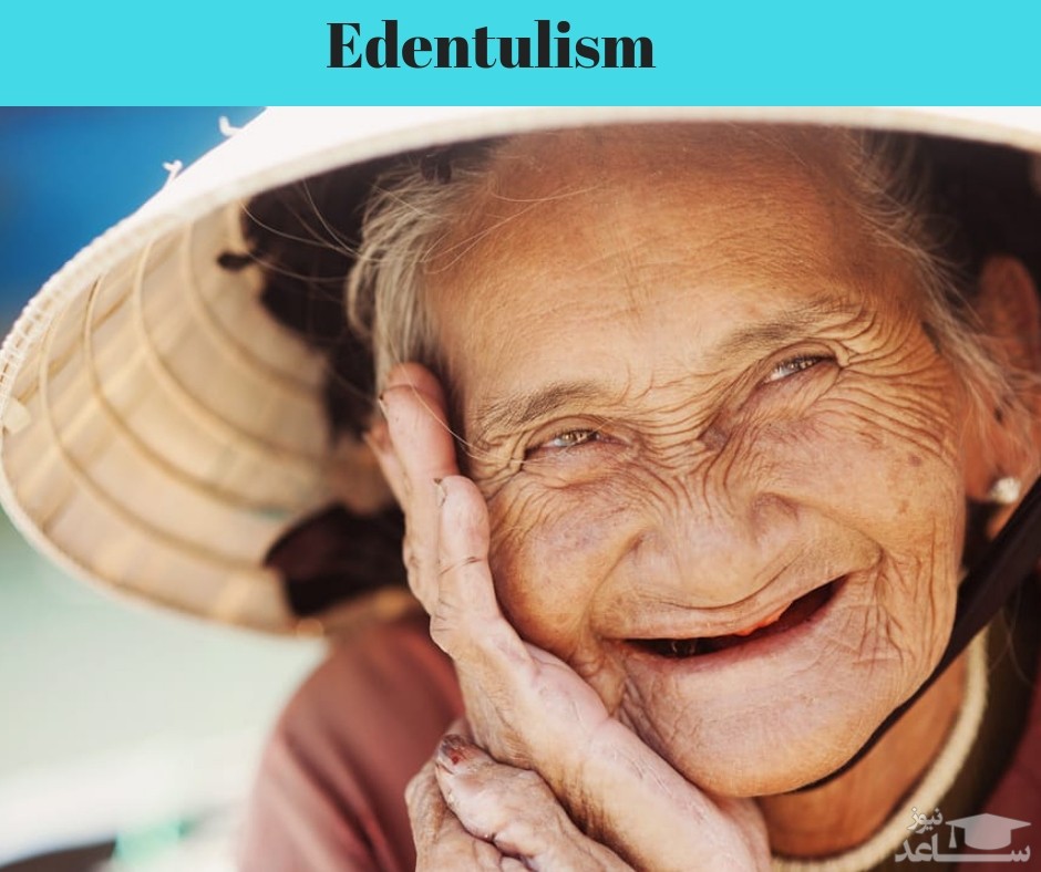 از دست دادن دندانها (ادنتولیسم)، علل و راه های پیشگیری و درمان