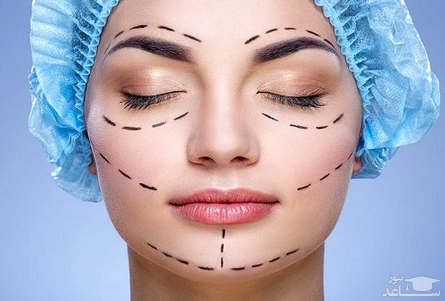نکاتی که باید قبل از انجام جراحی پلاستیک بدانید