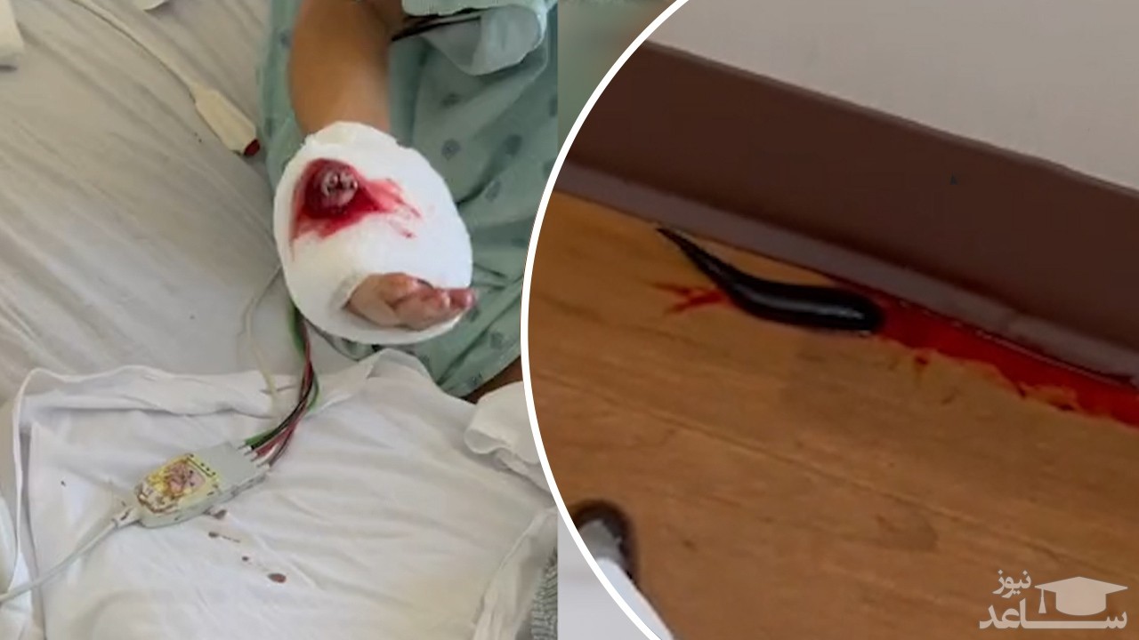 (فیلم) پیدا شدن ردی از خون در اتاق بستری بیمارستان