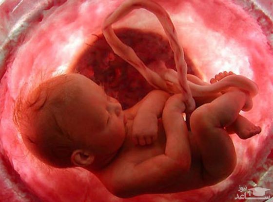 سقط جنین/ جرم سقط جنین چیست ؟