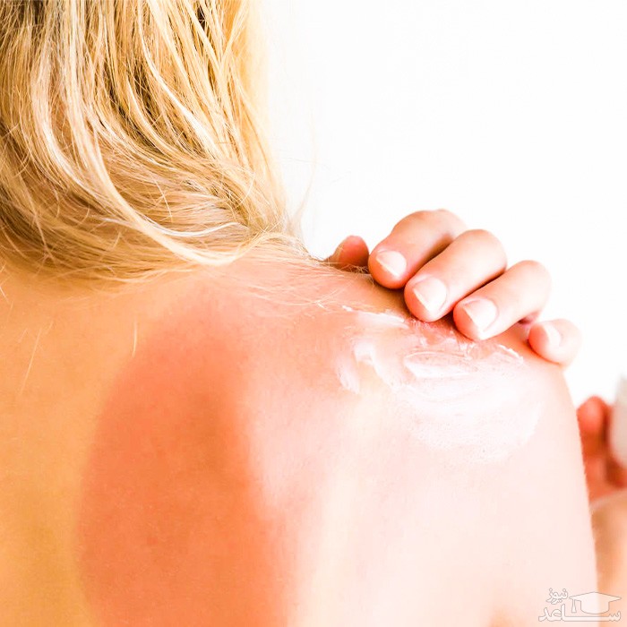  مصرف باسیتراسین