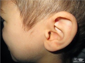 علایم و علل عفونت گوش در کودکان و راه های درمان