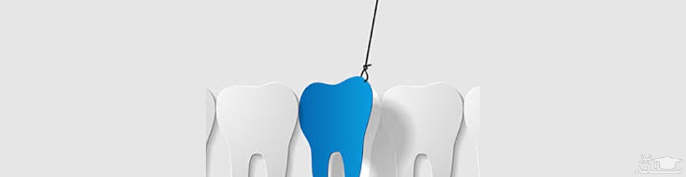 سوالات متداول و رایج درباره ی کیست دندان